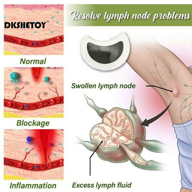 رقعة التخسيس الرعاية اللمفاوية - مراجعة Herbal Weight وسعره
